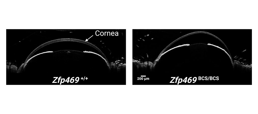 Mouse model lends insights into genetic eye condition: News 9.2021