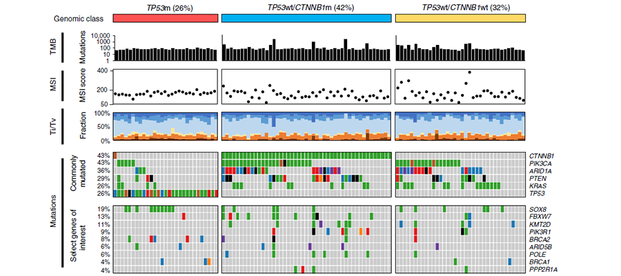 Image showing classification of endometrioid ovarian carcinoma proposed by Hollis et al.