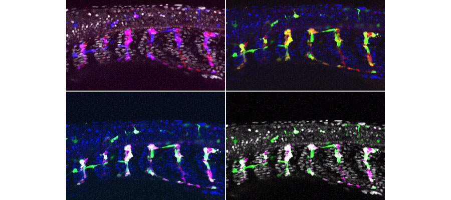 ZebraFish Melanoma