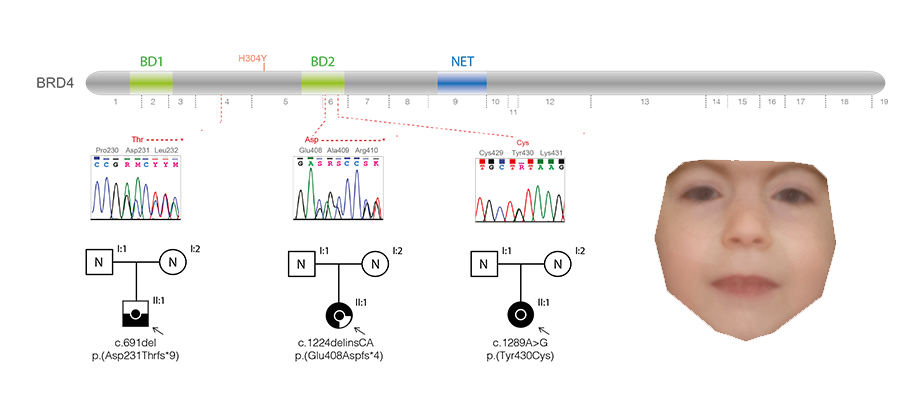 super-enhancer link developmental disorder