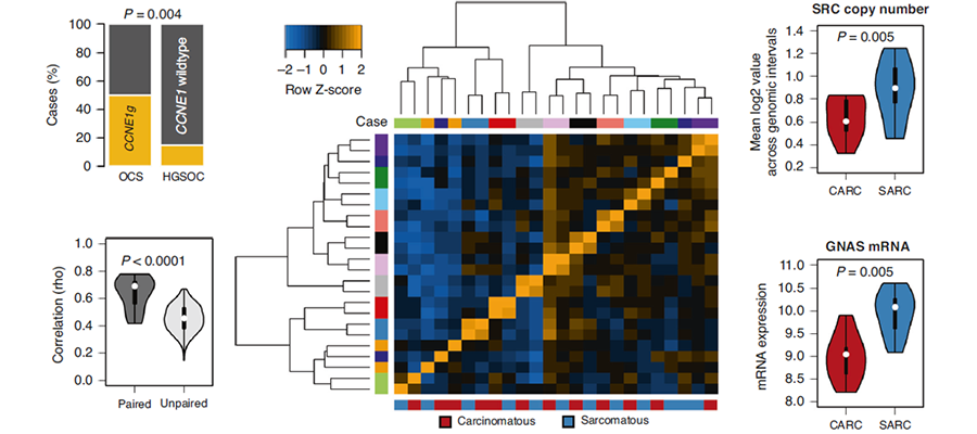 Genomic features of ovarian carcinosarcoma (OCS)