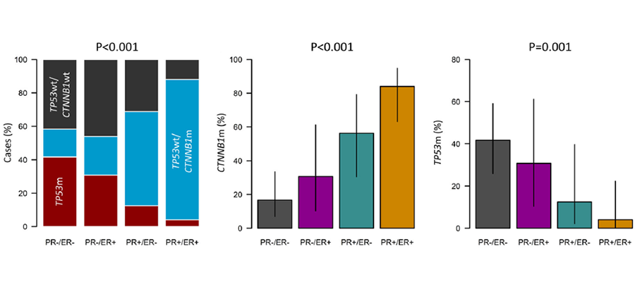 Relationship between endometrioid ovarian carcinoma subtypes.