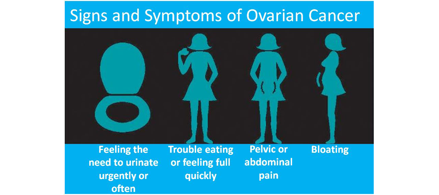 Signs and symptoms of ovarian cancer. 